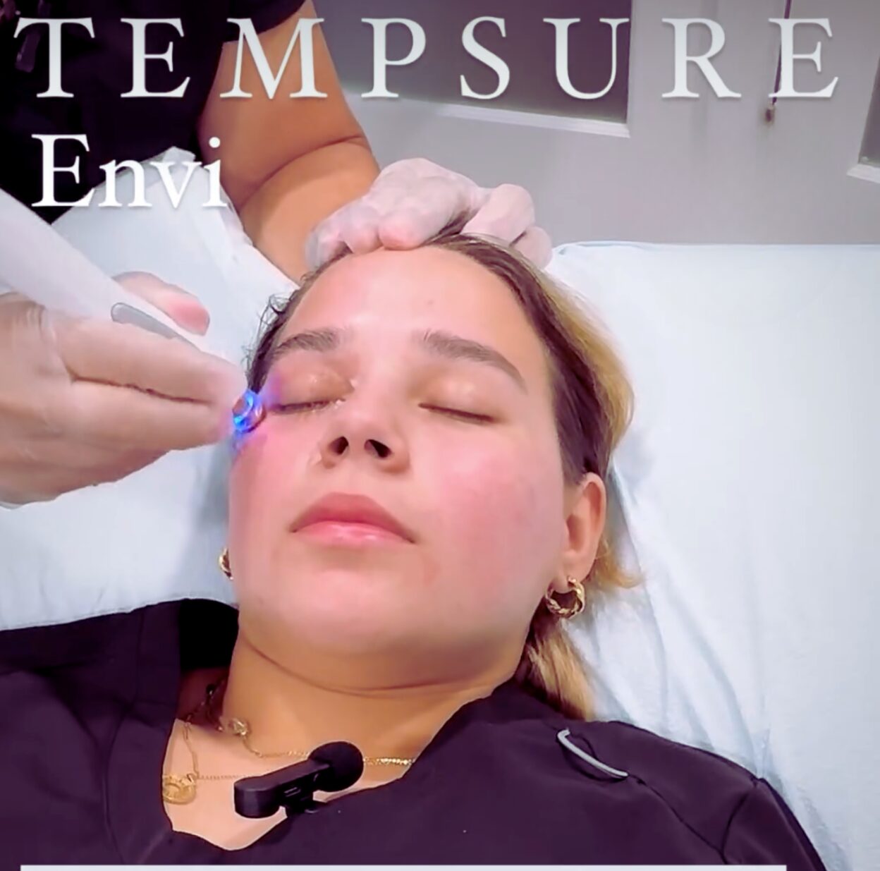 TempSure Envi RF